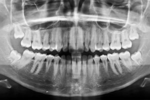 zahnarztpraxen 3 verkauf von zahnarztpraxen nachfolger optimiert DenPhaMed